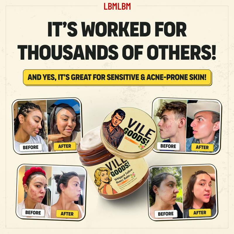 VILEGOODS! Whipped Beef Tallow & Manuka Honey Organic Nourishing Face Cream Moisturizer Body Lotion Skin Care Lip Balm Hydrating Moisturizing 100% Natural ingredients-Oil