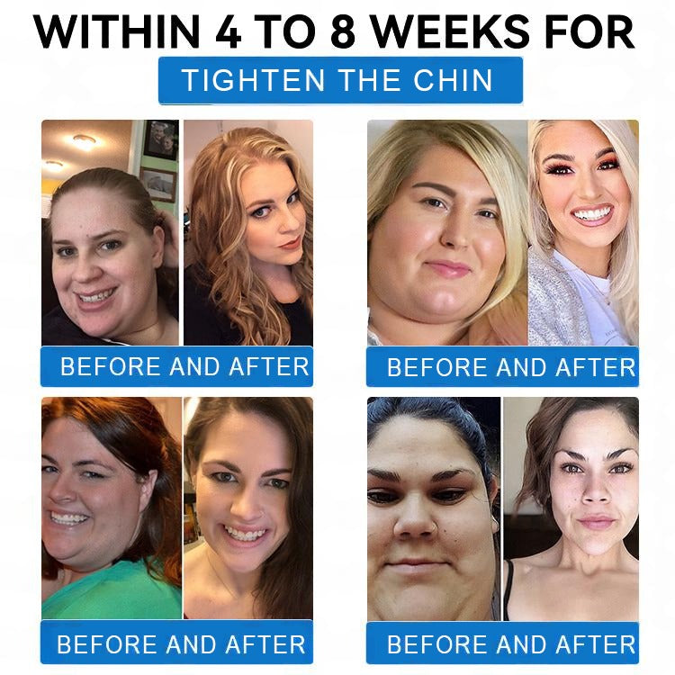 Best Seller-LBMLBM® SMGT-GLP-1 𝐓𝐢𝐫𝐳𝐞𝐩𝐚𝐭𝐢𝐝𝐞 & 𝐂𝐨𝐥𝐥𝐚𝐠𝐞𝐧 𝐍𝐚𝐧𝐨 𝐌𝐢𝐜𝐫𝐨𝐧𝐞𝐞𝐝𝐥𝐞 𝐖𝐞𝐢𝐠𝐡𝐭 𝐋𝐨𝐬𝐬 𝐏𝐚𝐭𝐜𝐡丨Targets Obesity, Loose Skin, High Blood Pressure, Diabetes, Fatty Liver, Joint Pain, Brain Fog, Low Energy, Body Aches, and More