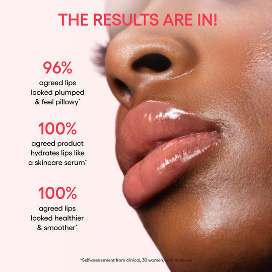 Gloss That Heals – Donut-Inspired Lip Therapy from Korea (Minimum 2)