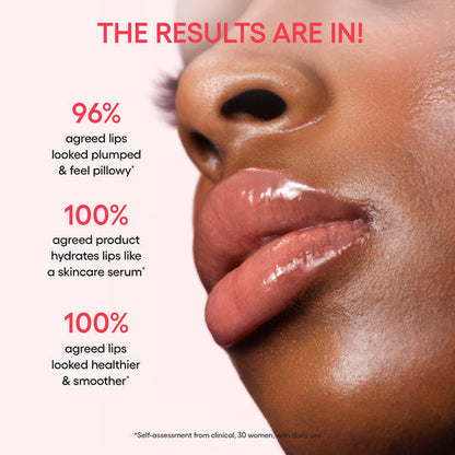 Gloss That Heals – Donut-Inspired Lip Therapy from Korea (Minimum 2)