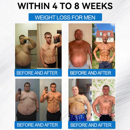 Best Seller-LBMLBM® SMGT-GLP-1 𝐓𝐢𝐫𝐳𝐞𝐩𝐚𝐭𝐢𝐝𝐞 & 𝐂𝐨𝐥𝐥𝐚𝐠𝐞𝐧 𝐍𝐚𝐧𝐨 𝐌𝐢𝐜𝐫𝐨𝐧𝐞𝐞𝐝𝐥𝐞 𝐖𝐞𝐢𝐠𝐡𝐭 𝐋𝐨𝐬𝐬 𝐏𝐚𝐭𝐜𝐡丨Targets Obesity, Loose Skin, High Blood Pressure, Diabetes, Fatty Liver, Joint Pain, Brain Fog, Low Energy, Body Aches, and More