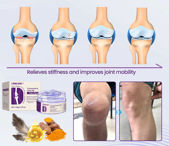 LBMLBM™ Curcumin & Emu Oil Pain Gel – 🏥 Backed by US Osteopathic Experts